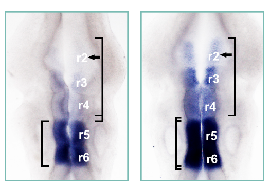 Embryonic brain stems