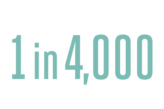 1 in 4000: the prevalence of DiGeorge syndrome, though experts suspect it is underdiagnosed