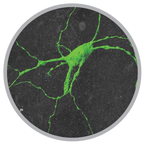 A neuron involved in swallowing, imaged as part of a grant to study pediatric dysphagia