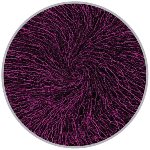 Long, conductive arms—or axons—of nerve cells branch and swirl across a mouse cornea. 